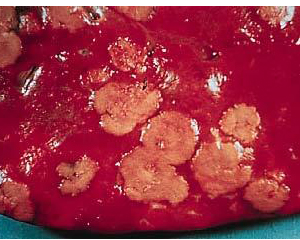 petopedija-nekrobacilioza-1