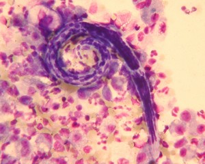 Plućni crv pod mikroskopom